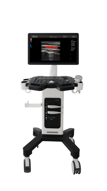 Color Doppler Ultrasound