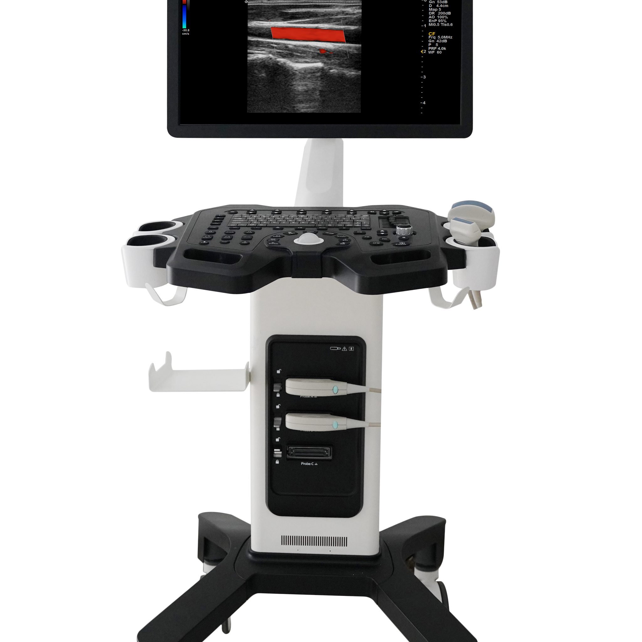 Color Doppler Ultrasound