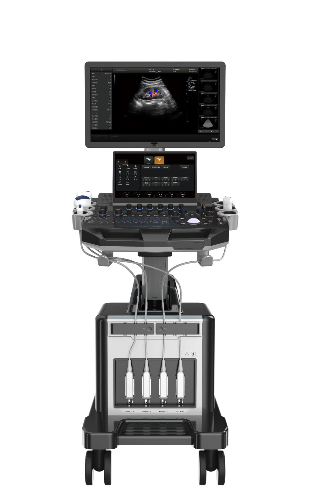 Color Doppler Ultrasound