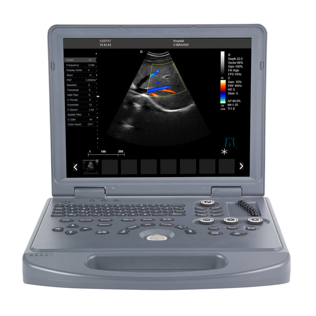 Portable Color Doppler Ultrasound