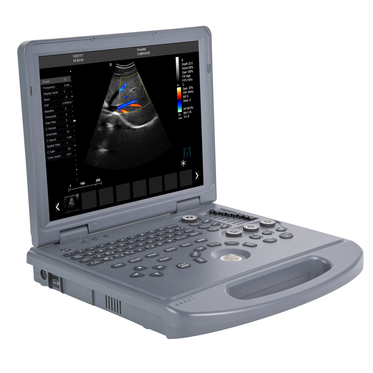Portable Color Doppler Ultrasound