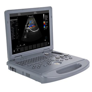 Portable Color Doppler Ultrasound